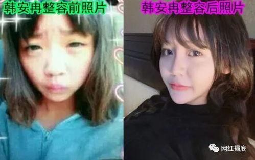 网红扒皮圈,真相与谎言的交织